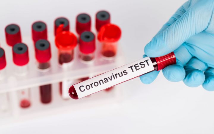 Azərbaycan Respublikasında koronavirus ilə bağlı son vəziyyət açıqlandı